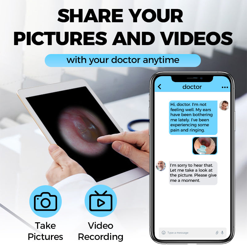 Rimozione elettrica del cerume con visualizzazione