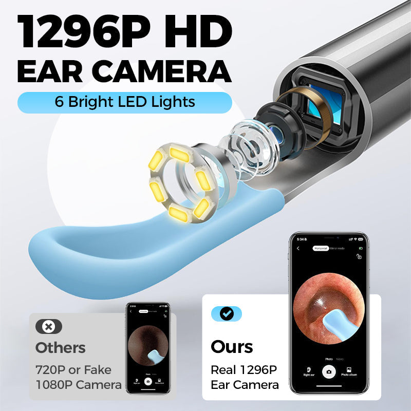 Rimozione elettrica del cerume con visualizzazione