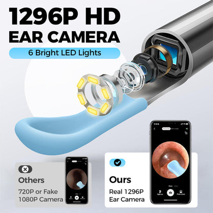 Rimozione elettrica del cerume con visualizzazione