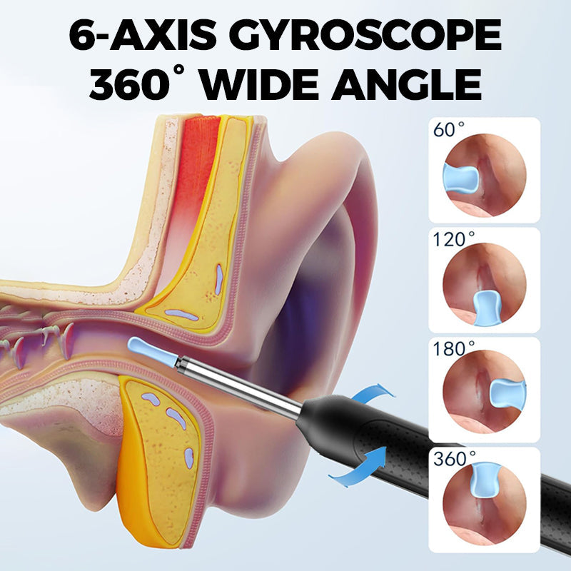 Rimozione elettrica del cerume con visualizzazione