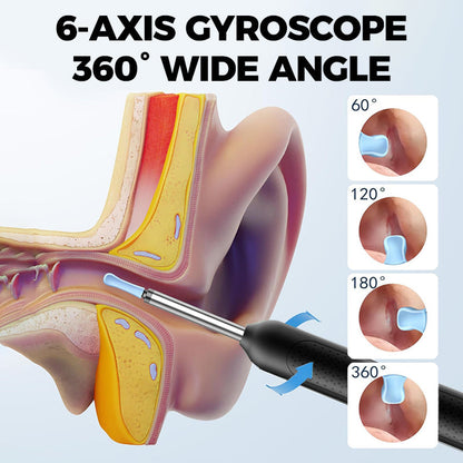Rimozione elettrica del cerume con visualizzazione