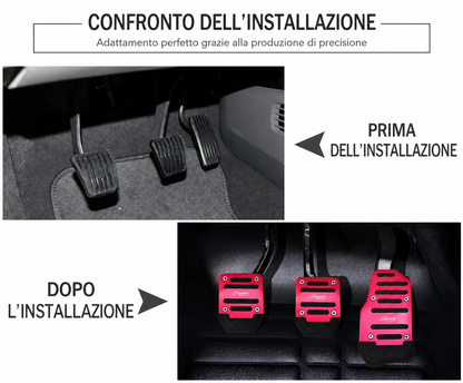 Kit Copri Pedali Auto Antiscivolo Universali R-Sports 🔴